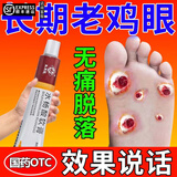 水杨酸软膏 乳膏10g去跖疣老茧瘊子脚皮可选鸡眼膏去肉刺药膏成人涂抹去除老茧药膏根 1盒【基础装】鸡眼瘊子去除肉刺药膏