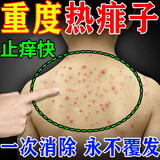 千方百剂痱子水祛痱止痒成人儿童热痱子瘙痒热痛小孩洗澡通用去痱喷雾 三盒装【2盒钱】立省19.8