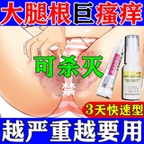 股藓股癣专用药膏大腿根内侧潮湿瘙痒股癣发黑男士私处止痒体癣花斑癣铜钱癣真菌感染克霉唑乳膏素喷雾剂软膏 1盒克霉唑乳膏素+1盒盐酸特比萘芬喷雾剂图视觉特效
