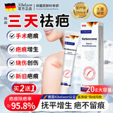 XIBELAON医用祛疤膏疤痕贴专用修复生长灵去疤膏烧烫伤增生疤痕儿童凝胶 买二送一手术烧烫摔伤增生【99%顾客选择疗程装】