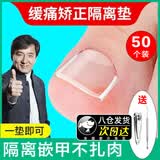 南京同仁堂甲沟炎矫正器嵌甲矫正器垫片神器脚趾甲专用指甲刀药贴片长在肉里 50个垫片+指甲刀剔甲器I次日达 甲沟炎填充垫片剔甲器指甲剪