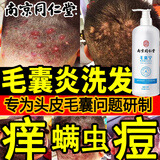 南京同仁堂毛囊清洁洗发水毛囊I炎宁去屑止痒洗发水除螨控油蓬松男女士500ml