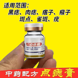 点痣膏水疤痕修复脸部去痣点痣膏官方正品祛斑点斑专用非药点疣水 1盒普通装【点痣膏】