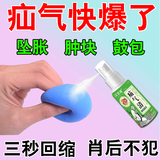 汉百通【药店出库】疝气清药喷雾消剂婴儿童中老年人腹股沟肚脐疝气贴带 5瓶【巩固疗程装】