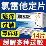 恒医森 氯雷他定片 14片 迅速缓解过敏性鼻炎药荨麻疹止痒皮肤过敏药内服 1盒装【标准装】