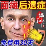 协和面瘫100%专用的药面瘫后遗症牵正贴眼歪嘴斜治疗面瘫穴位中药贴 特效贴一盒 【京配物流 部分地区次日达】