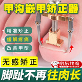 甲沟矫正器嵌甲矫正器卷甲纠正神器防脚指甲长肉里专用修脚工具炎 金色（透明胶盒）包装/一盒装