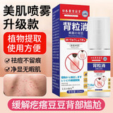 KOOGIS背粒消喷雾升级美肌祛痘膏毛囊炎去胸前硬疙瘩痘印背部长痘消痘