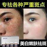 崇姿美白嫩肤祛斑霜提亮保湿面霜黄褐斑雀斑烟酰胺改善暗黄肌肤 一盒装