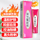越洋新肤螨灵霜除螨虫滋润控油爽肤痤疮青春痘坑痘印修护软膏