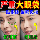 碧素堂眼袋去除神器眼袋贴霜去眼袋消除重度眼袋男女士专用中老年去眼纹 三盒装【95%人的选择】 180片 眼膜眼袋提拉紧致抗皱淡化黑眼圈