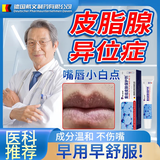 皮脂腺异位嘴唇长小颗粒嘴唇上长小白点皮脂腺异位症可搭配去除嘴唇白点嘴唇上的小白点嘴唇颗粒唇颗粒N3 一盒标准装【嘴唇皮脂腺专用膏】送棉签