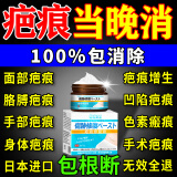 同仁堂祛疤痕专用修复凝胶药膏儿童芭巴疤痕增生凸起去除克疙瘩手术缝针 单盒：儿童祛疤膏小孩面部专用 美化皮肤保护去除疤痕膏药贴