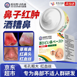 ADPWY酒糟鼻膏可搭酒糟鼻专用护肤乳药膏草莓鼻红鼻子红血丝30g/盒