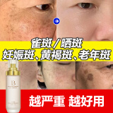 贝玲美祛斑美白抗皱精华乳水润提亮肤色改善干燥淡化细纹补水保湿面霜 一盒装