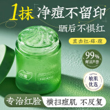 ORGINESE芦荟胶B5修复皮肤晒伤舒缓泛红补水保湿非祛痘印淡化疤痕男女士