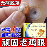 鸡眼贴去看根去看肉刺刺猴无痛脱落脚底老茧跖疣脚底 鸡眼去发除药【视觉特效】水杨酸苯酚贴膏 3盒装【反复鸡眼掉了又长】对症一贴