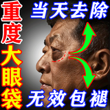 妍瑟眼贴膜淡化细纹去眼袋黑眼圈提拉紧致男女士熬夜去黑眼圈去除神器 一盒装【120秒速消眼袋】应急用