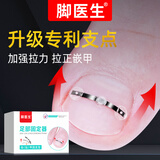 Dr.JYS甲沟炎矫正器三点式趾甲矫正贴片/套足部固定器脚指嵌甲纠正甲贴