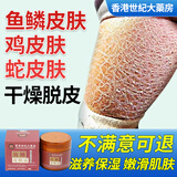 鱼鳞皮肤保湿霜蛇皮肤腿纹路专用毛囊毛周角化脱皮起皮润肤身体乳 套餐 1盒(100g)【初步效果 淡化纹路】