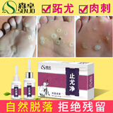 森卓止尤净跖疣专用非药脚底趾疣根鸦胆子脚上疣体肉刺祛疣去除非药膏 【第二盒半价】两盒装去尤乐