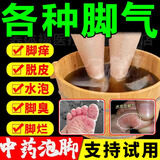 艳锦堂脚气泡脚中药包除i脚气脚臭脚汗止痒脚痒脱皮抑菌中草足浴泡脚包 30小包/袋