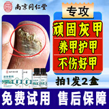 南京同仁堂灰指甲灰甲净套装（30ml敷料+护理盒）*2