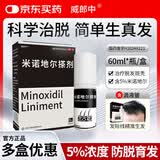 威郎中 米诺地尔搽剂 5%*60ml/盒 治疗男性脱发 防脱生发固发【严重脱发】斑秃际线后移增长修复育发生发液药