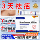 XIBELAON德国医用祛疤膏疤痕贴专用修复灵疤克去疤烧烫伤增生疤痕儿童凝胶 祛疤痕套装【祛疤痕药膏搭修复疑胶疤痕贴】
