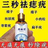 康宛堂点痣点疣药水去痣点痣膏疤痕修复液美容院专用祛痣膏药脸部不留疤 单盒疣瘊灵【去黑痣建议拍套装】