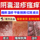 修正阴囊潮湿瘙痒阴囊炎睾丸瘙痒湿疹膏肛门大腿内侧皮肤瘙痒止痒男性 一套初期装（双效型） 阴囊湿疹潮湿瘙痒男人专用止痒去根