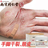 鸢尾猫干裂修复霜皲裂膏护手霜男非止痒手脚裂口手足裂防裂防冻手指脱皮 1瓶装（1双脚套50只手套）