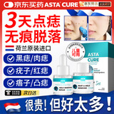ASTACURE点痣膏脸部去痣专用水无痕脸部痦子扁平疣正品无痛黑痣祛痣男女士