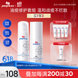皮宝祛痘控油套装祛痘精华控油精华乳CP舒缓油痘敏肌温和祛痘粉刺闭口 点痘精华15克+控油精华乳15克