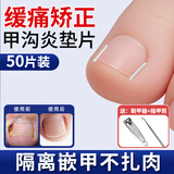 洁比世甲沟炎矫正脚指甲矫正修正器隔离填充垫片脚趾甲长在肉里修剪神器