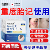 冈泷制药胎记去除神器脸部黑色素太田痣咖啡斑淡化遗传胎记全身胎记祛除膏