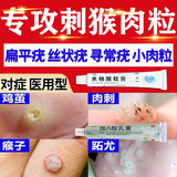 水杨酸软膏去疣专用药丝状疣扁平疣脖子上颈部专用药祛疣瘊子扁平疣去脖子上的小肉粒祛疣特i药肉粒疙瘩去疣 2盒水杨酸软膏【脖子小肉粒 影响美观】店长推荐