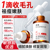 透真杏仁酸精华液收缩毛孔粗大修复细致果酸水杨酸祛痘淡痘印痘坑修护