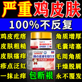 岩井昃弘鸡皮肤疙瘩毛周角化症药膏专用毛囊角质疙瘩大腿手臂100%去除神器 一盒体验特效膏
