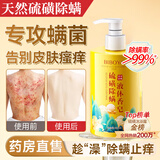 BEAUTY NOTES硫磺沐浴露除螨液体香皂男女士去背后痘痘印控油止痒去角质500ml