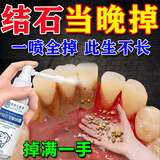 牙结石清理神器牙垢清除专用膏抑菌除i去i口臭口气重嘴巴臭溶解液 喷雾:3盒【顽固牙石】轻松去除 去i除i口臭口气重嘴巴臭