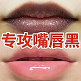 嘴唇黑色素去除唇周黑去黑嘴角发黑暗沉改善嘴唇暗沉淡化唇角边黑 特效【跟断嘴唇周边黑】3瓶 45ml 唇周黑去黑医用嘴唇发黑发紫去除嘴巴暗沉黑色素