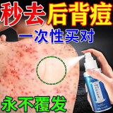 同仁堂后背痘痘药膏后背长痘痘毛囊炎专用前胸后背部脓包痤疮祛痘喷雾剂 一盒装【多买多送】发货特效快