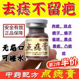 DAGO点痣膏脸部去痣专用去痣点痣膏黑痣无痛无痕去痣膏+润肤脂