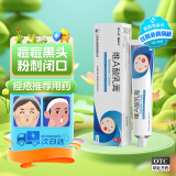 保益宁维A酸乳膏 0.05%*20g祛痘膏痤疮去闭口粉刺黑色素改善鸡皮青春痘丘疹脓疱暗疮痘痘药膏祛痘凝胶