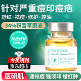 研问34%积雪草原液祛痘痘后红印去粉刺闭口舒缓修护寡肽精华液男女 积雪草原液1瓶10ml