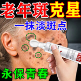 岩井昃弘祛斑点斑专用水药去斑霜去黑色素脸部手背医用正品老年斑晒斑进口 【效果不佳】1盒美白祛斑霜 祛斑霜老年斑专用特效非药一夜消