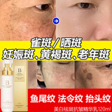 贝玲美祛斑美白抗皱精华乳水润提亮肤色改善干燥淡化细纹补水保湿面霜 一盒装