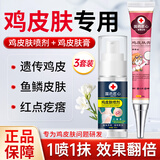 示博士鸡皮肤疙瘩搭毛囊角化症专用的药去角质大腿手臂去除神器特傚膏用 三套【中度鸡皮】鱼鳞皮蛇皮疙瘩 搭身体乳去鸡皮毛囊角质疙瘩品用