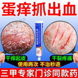 糠酸莫米松乳膏治疗男士阴囊湿疹私处瘙痒止痒药膏男性阴部裆部潮湿闷热瘙痒男人会阴部大腿内侧瘙痒红肿脱皮 1盒20g【糠酸莫米松乳膏】 私处护理乳膏液湿疹专用止痒去西药根